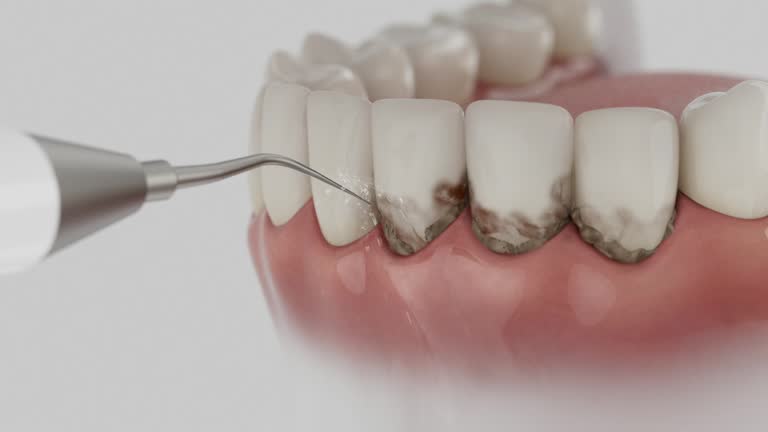 Reliable Teeth Cleaning And Checkup contractor in Monroe County County, GA by Dentist Open Now
